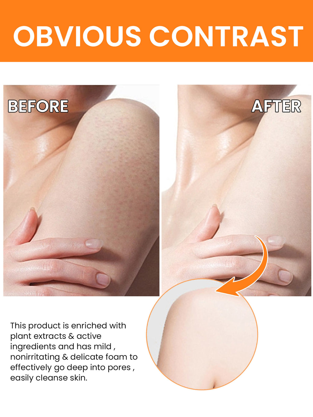 Turmeric Serum – Dark Spot Corrector & Brightening Oil